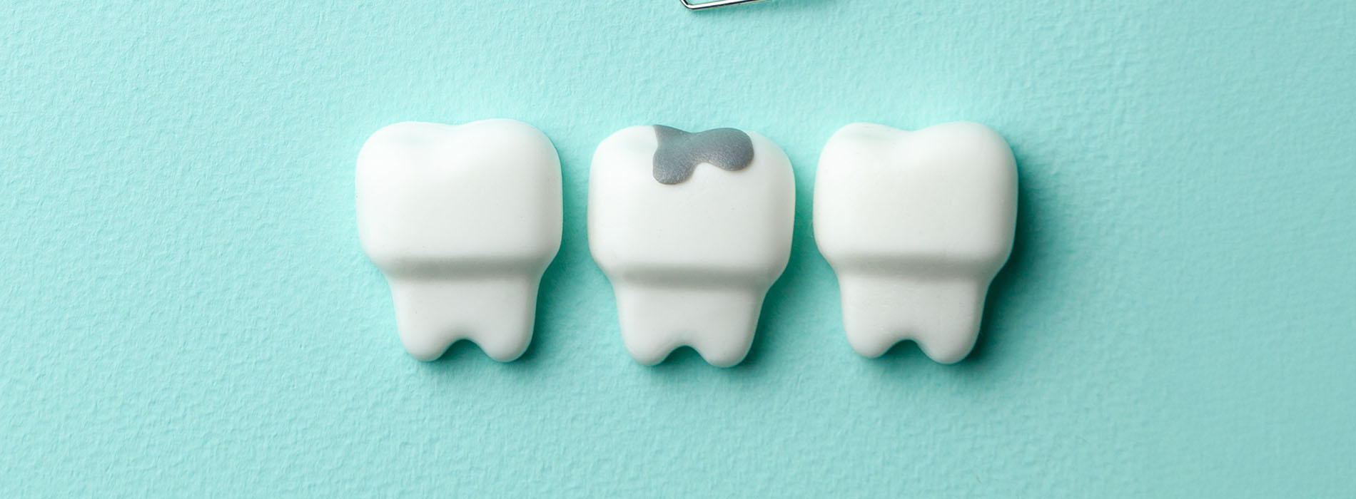 The image shows four tooth-shaped white objects with black details arranged on a surface against a blue background.