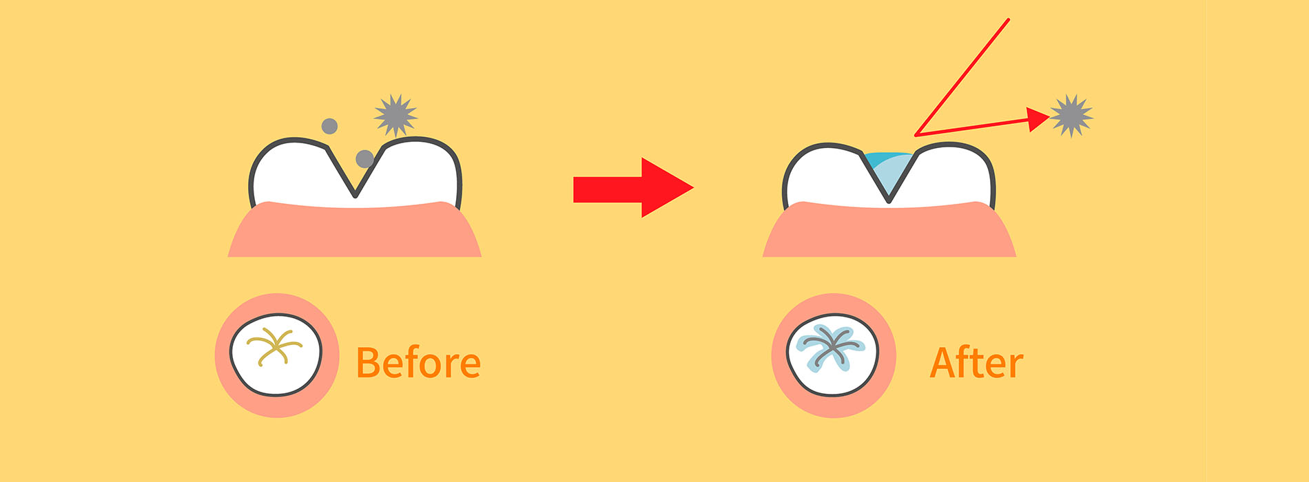 The image shows a before-and-after comparison with an arrow pointing from the  before  side to the  after  side, illustrating the transformation of a surface with a substance that appears to be either cream or paint, highlighting its effect on the texture and color of the surface.